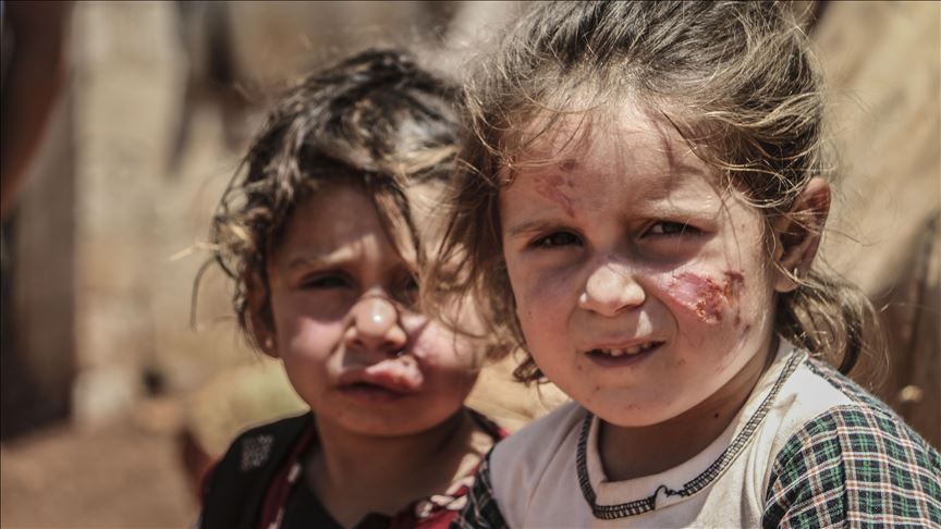 Në kampet e refugjatëve në Idlib po përhapet sëmundja Leishmanioza