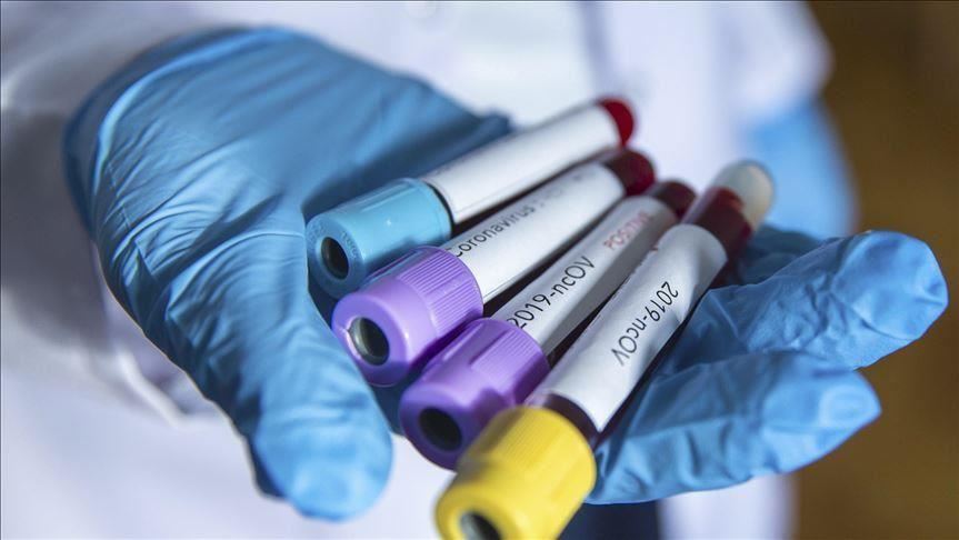 Crna Gora: Registrovana 53 nova slučaja koronavirusa