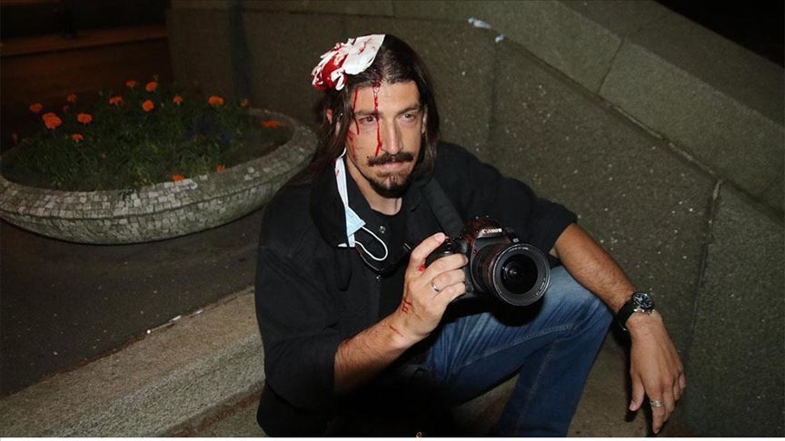 Beograd: Fotoreporter AA povređen tokom protesta ispred Skupštine Srbije