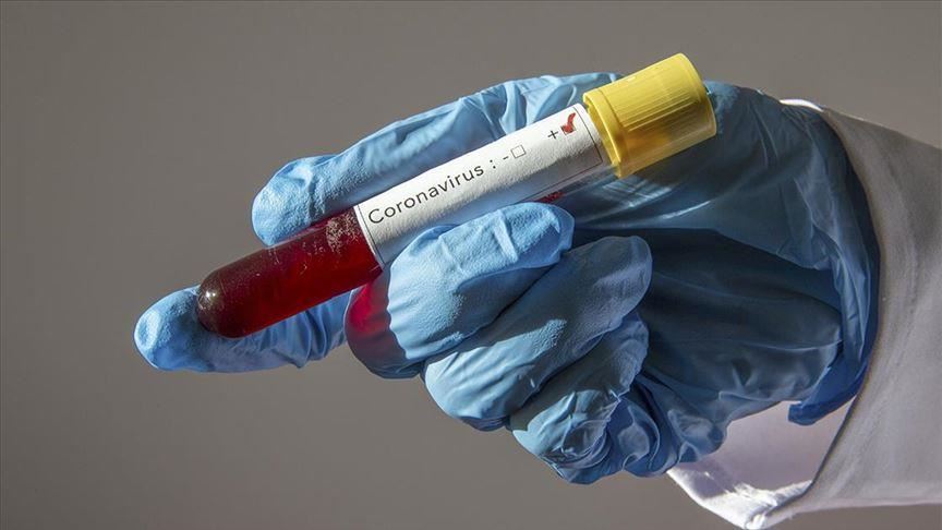 Crna Gora: Registrovana 64 nova slučaja koronavirusa