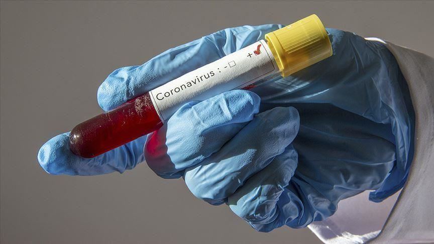 France/Covid-19: 10 nouveaux décès à l’hôpital portant le bilan à 30 192 morts (officiel)