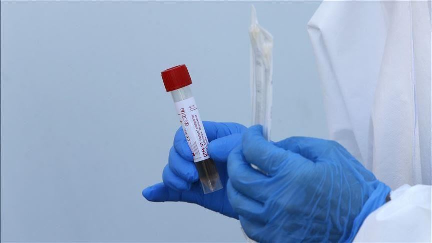 Crna Gora: Registrovano još 86 novih slučajeva koronavirusa, jedna osoba preminula