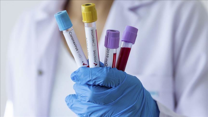 BiH: Potvrđeno 188 novih slučajeva zaraze koronavirusom