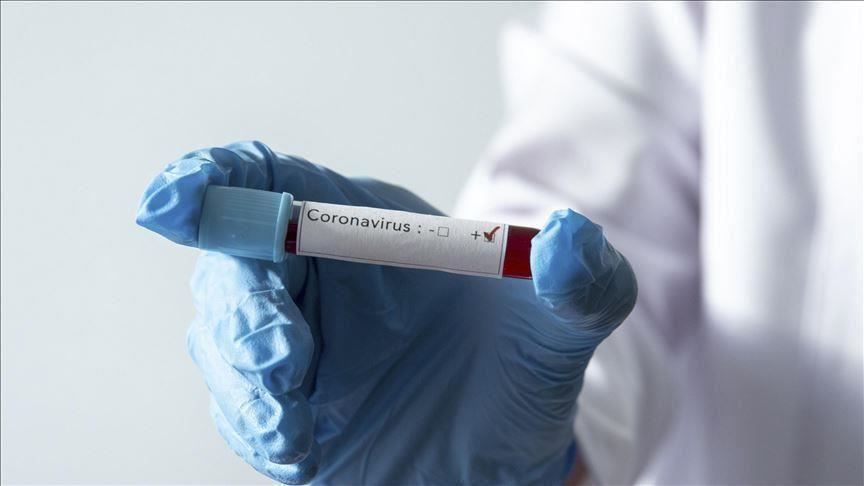 Crna Gora: Registrovana 43 nova slučaja koronavirusa