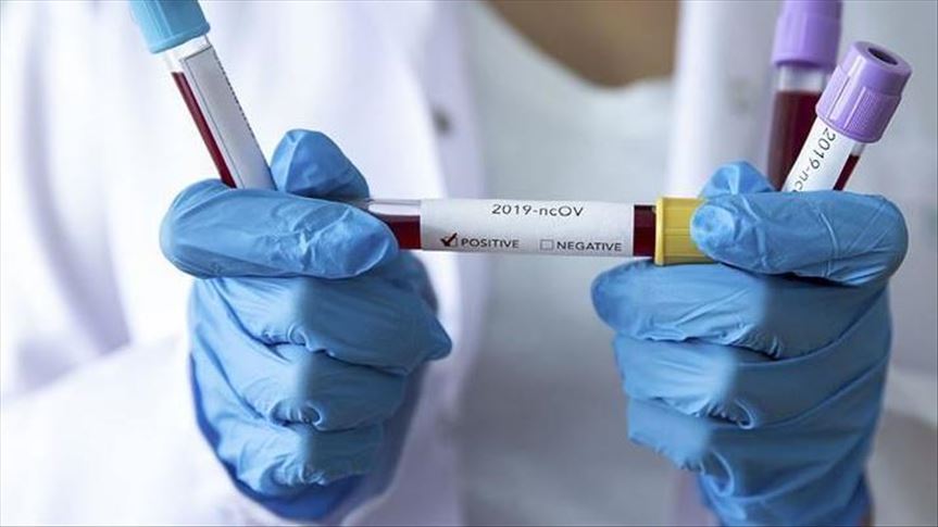 South Africa reports 2,810 new virus cases, 259 deaths