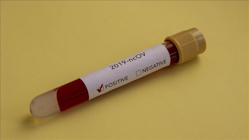 South Africa reports 260 new COVID-19 deaths