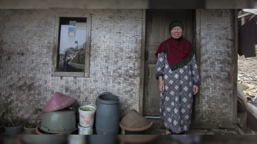 Les personnes albinos sont victimes de la superstition en Afrique