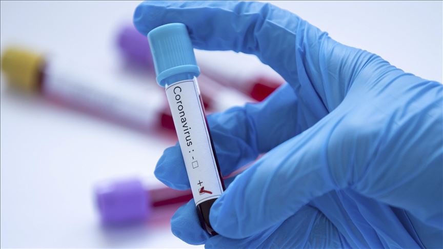 Srbija: Još tri osobe preminule od koronavirusa, 170 novozaraženih 