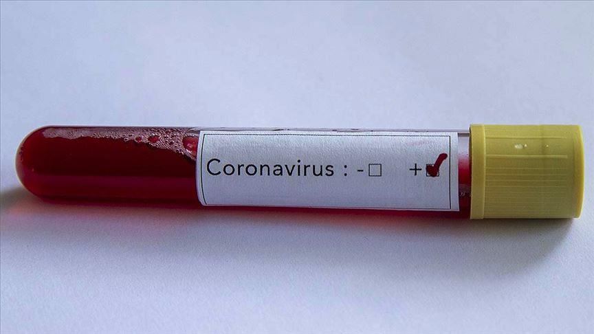 SHBA, sekuenca të ndryshme të viruseve tek i riu për herë të dytë me COVID-19