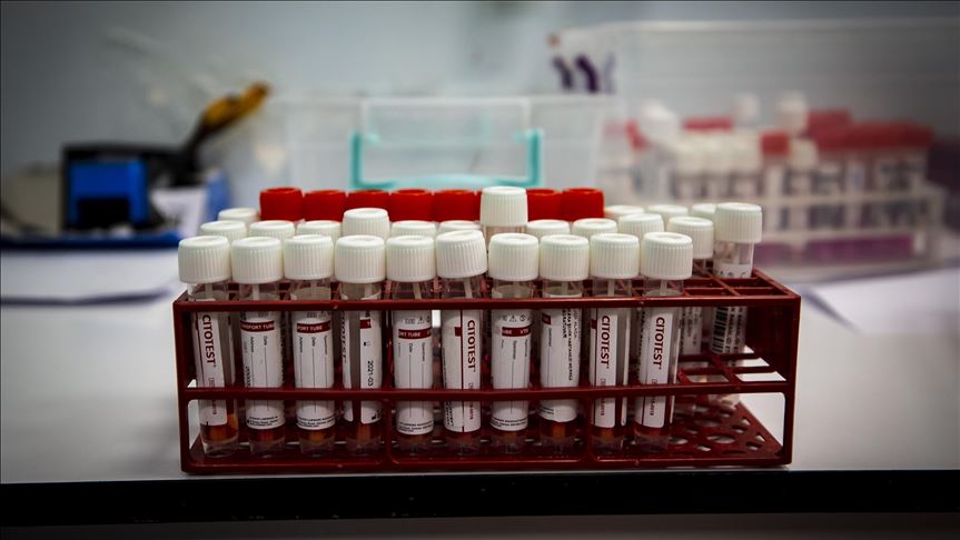 En Perú 3.000 personas se inscribieron para los ensayos clínicos de una vacuna contra la COVID-19