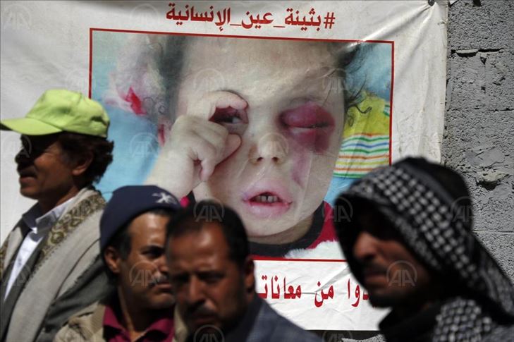 Koalisi Saudi bombardir posisi Houthi di Sanaa