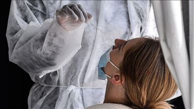 Covid-19 : Le bilan mondial des contaminations dépasse les 30 millions de cas confirmés