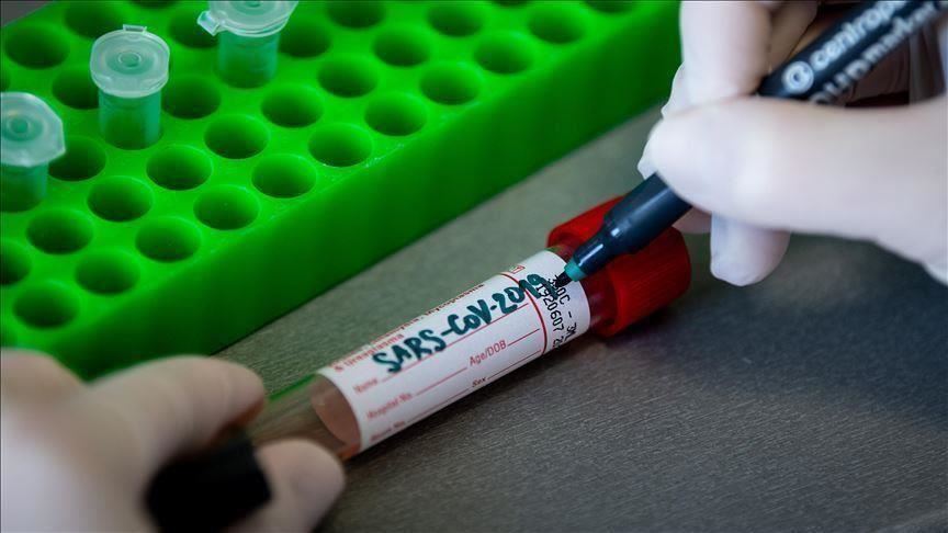 Kosovë, 2 të vdekur dhe 79 raste të reja me COVID-19