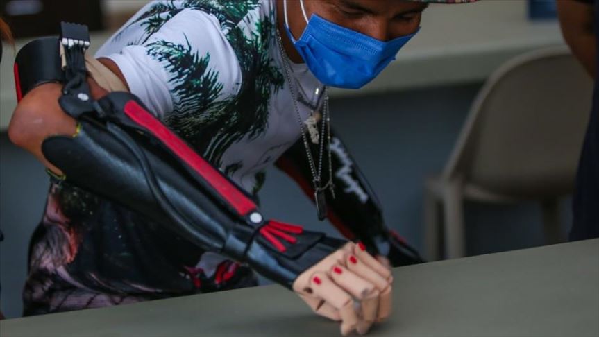 Jaider, el indígena colombiano que recuperó la esperanza gracias a prótesis impresas en 3D