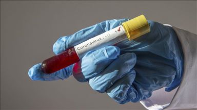 UK could miss COVID-19 testing target due to supply lag