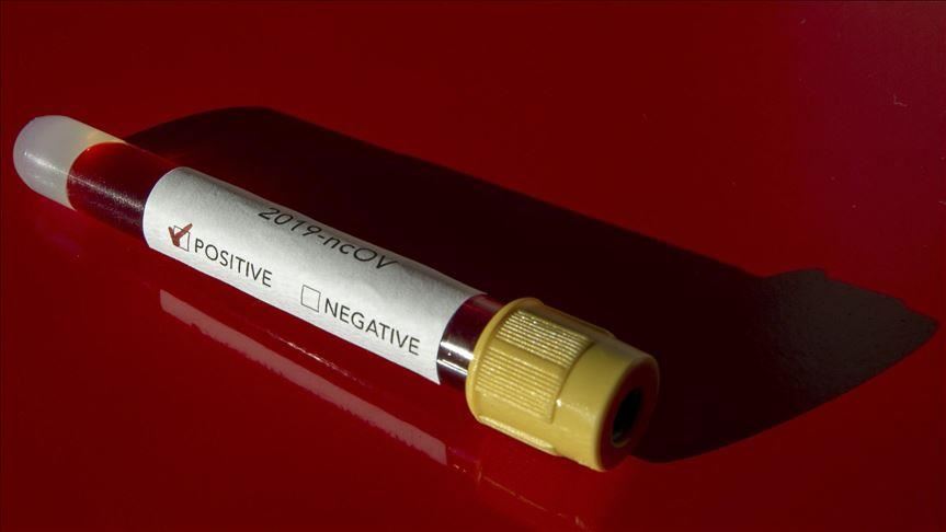 BiH: U RS-u još 177 osoba pozitivno na koronavirus