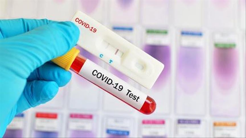 В Бишкеке впервые выявлены повторные случаи заражения COVID-19