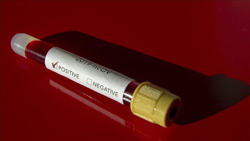 Srbija: Još dve osobe preminule od koronavirusa, 416 novozaraženih