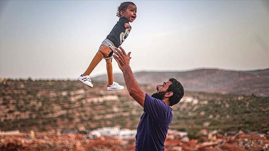 Tirkiyeyê ji bo Mihemedê biçûk çîmên protez temîn kir û dilê wî xweş kir