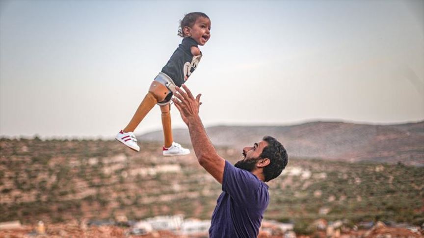 طفل سوري يعود لبلاده بعد تركيب أطراف اصطناعية في تركيا