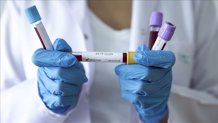 Crna Gora: Registrovano 177 novih slučajeva zaraze koronavirusom, dvije osobe preminule
