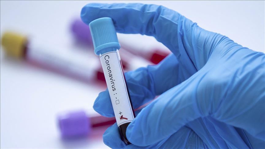 BiH: U  RS-u 14 smrtnih slučajeva, još 630 osoba pozitivno na koronavirus