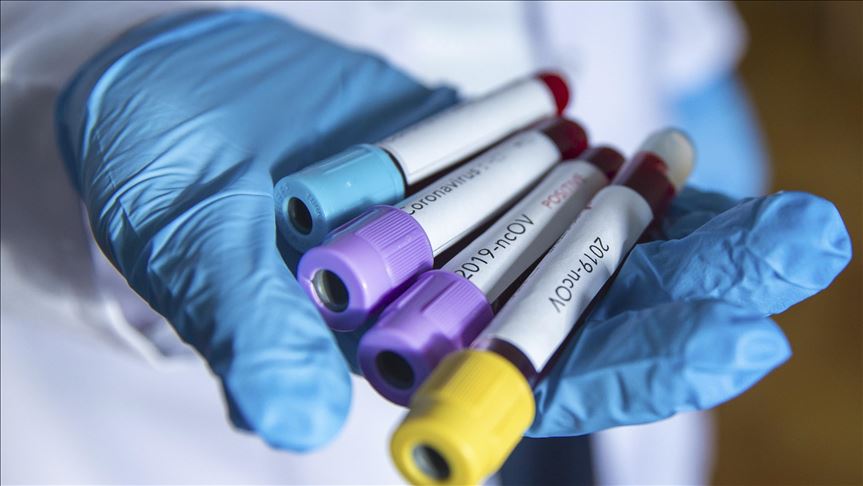 Srbija: Šest osoba preminulo od koronavirusa, 1.384 novozaraženih