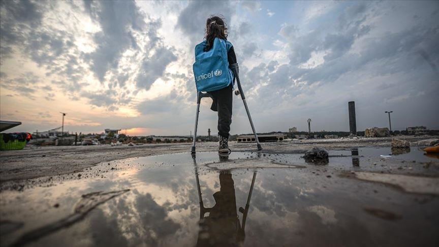 للذهاب لمدرستها.. طفلة سورية تحلم بطرف اصطناعي 