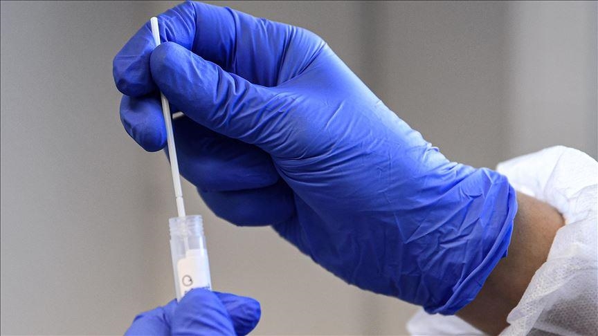 Crna Gora: Registrovano 620 novih slučajeva infekcije koronavirusom, devet osoba preminulo
