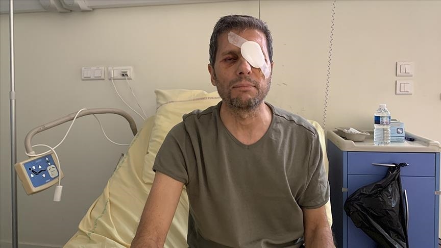 Прокуратура Парижа отказалась возбуждать дело о полицейском насилии