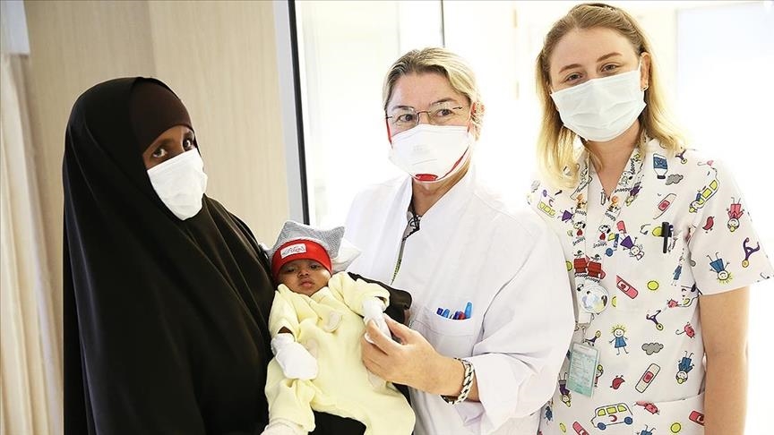 Somali parasitic twin undergoes surgery in Turkey