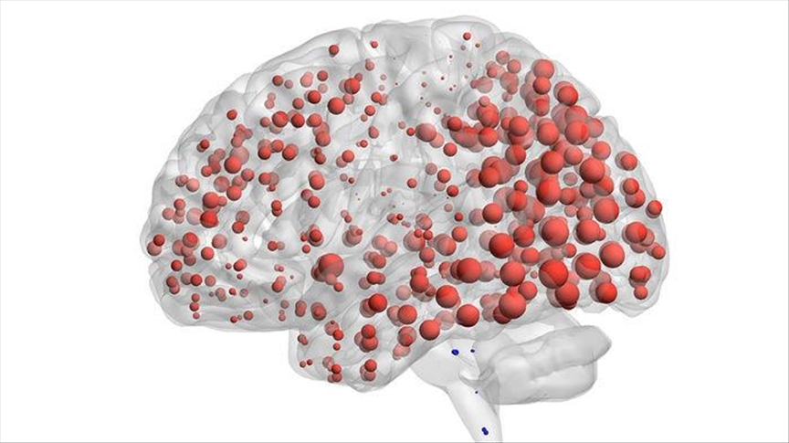 Brasil espera contar con un medicamento contra el Alzheimer en 2022
