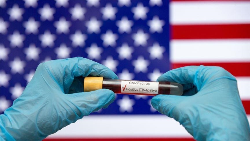 Число жертв коронавируса в США превысило 283 тыс