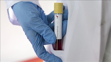 COVID-19 update in Arab countries