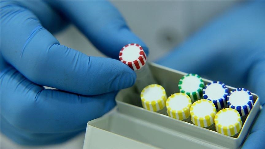 Turkish doctor develops urine kit to detect COVID-19