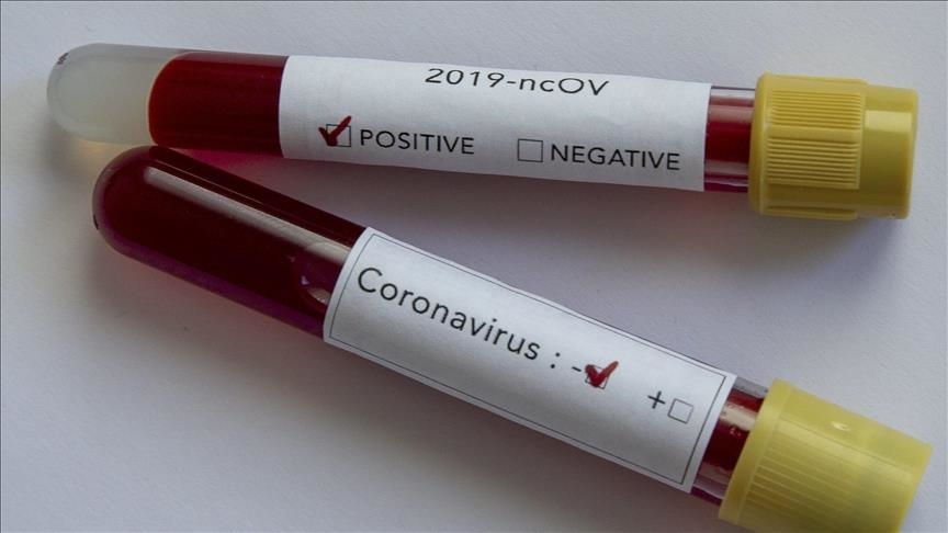 9 arrested at coronavirus protests in Denmark