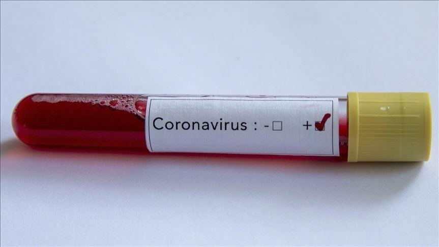 Crna Gora: Registrovano 310 novih slučajeva koronavirusa, još jedna osoba preminula