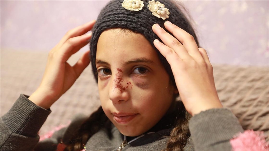 Zapadna obala: Palestinska djevojčica bila izložena napadu i pokušaju otmice od jevrejskih doseljenika