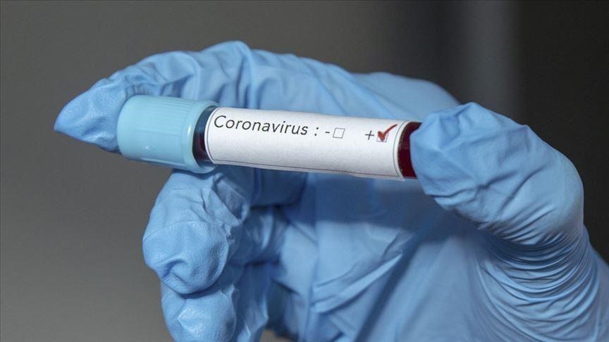 Zimbabwe: Coronavirus claims transport minister