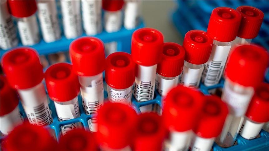 Crna Gora: Registrovan 381 novi slučaj zaraze koronavirusom
