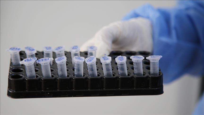 Во Северна Македонија детектиран првиот случај на британскиот сој на коронавирус