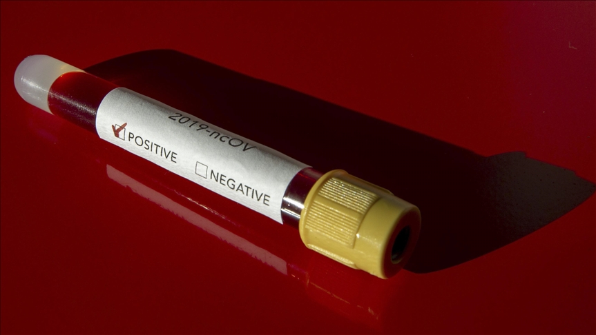 Crna Gora: Registrovana 571 novozaražena osoba koronavirusom, preminulo još pet pacijenata