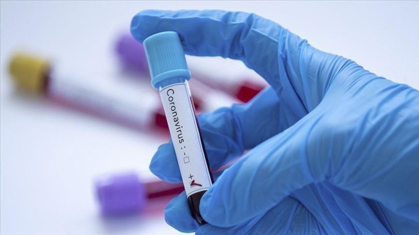Covid-19/Tunisie : 562 nouvelles contaminations et 25 décès enregistrés
