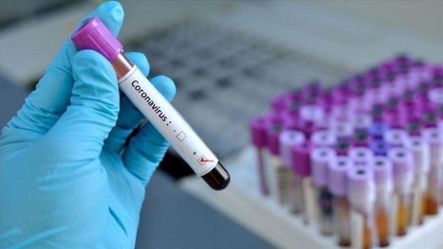 Crna Gora: Preminulo još 11 osoba, 603 nova slučaja zaraze koronavirusom