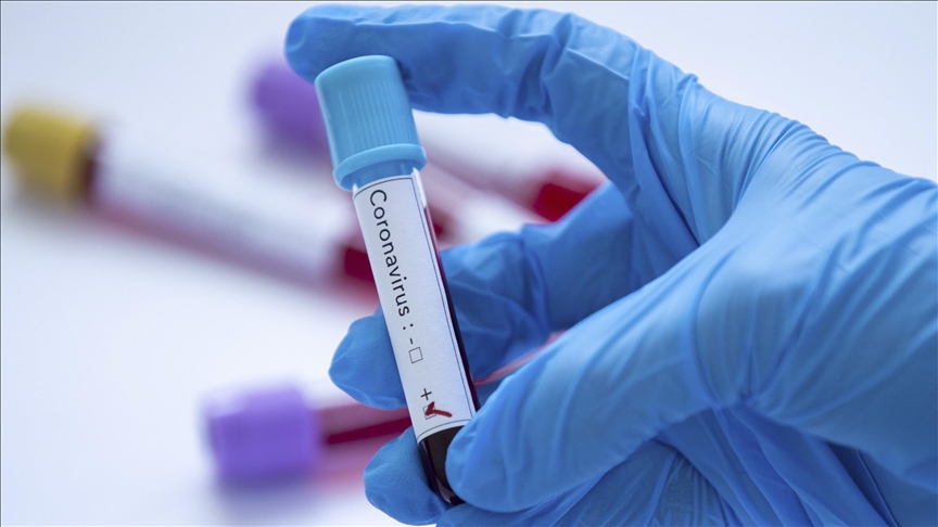 BiH: U RS-u zaraza koronavirusom potvrđena kod još 86 osoba, 12 smrtnih slučajeva