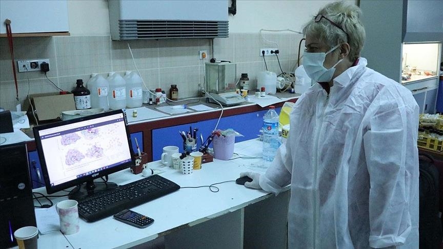 Turkey: Discovery could help block COVID-19 replication