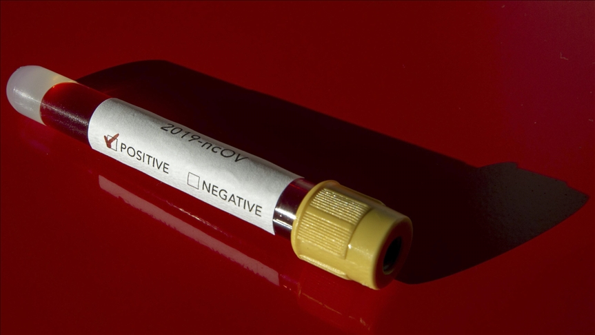 Srbija: Preminulo još 40 osoba, 4.398 novozaraženih koronavirusom