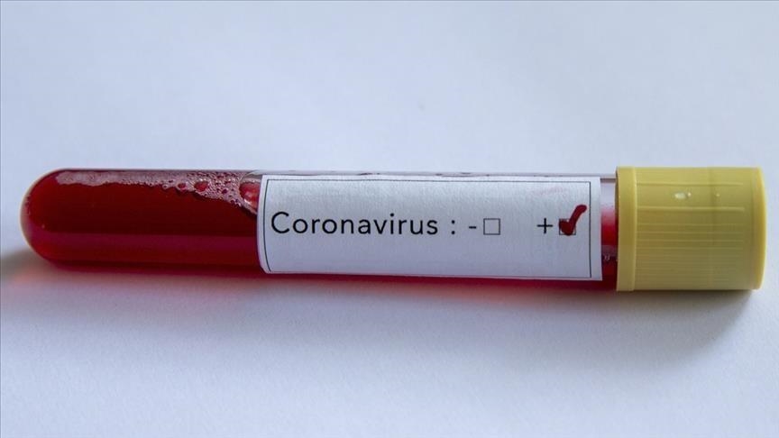 La France a signalé plus de 43200 cas du nouveau coronavirus
