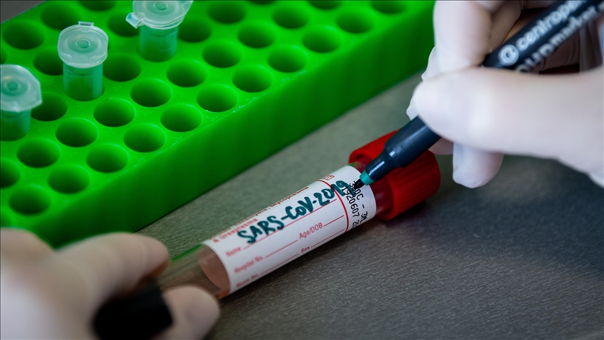 BiH: Registrovano 722 novozaraženih koronavirusom, preminulo još 86 osoba