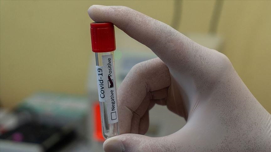 'Smell training' advised for COVID-19 survivors
